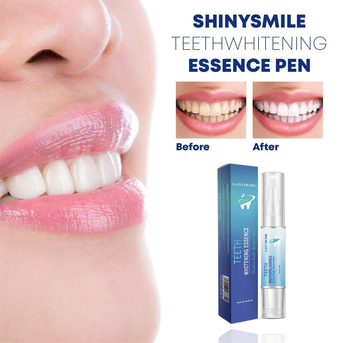 Smilevera esencia blanqueadora – blanqueamento dental suave e efectivo na casa